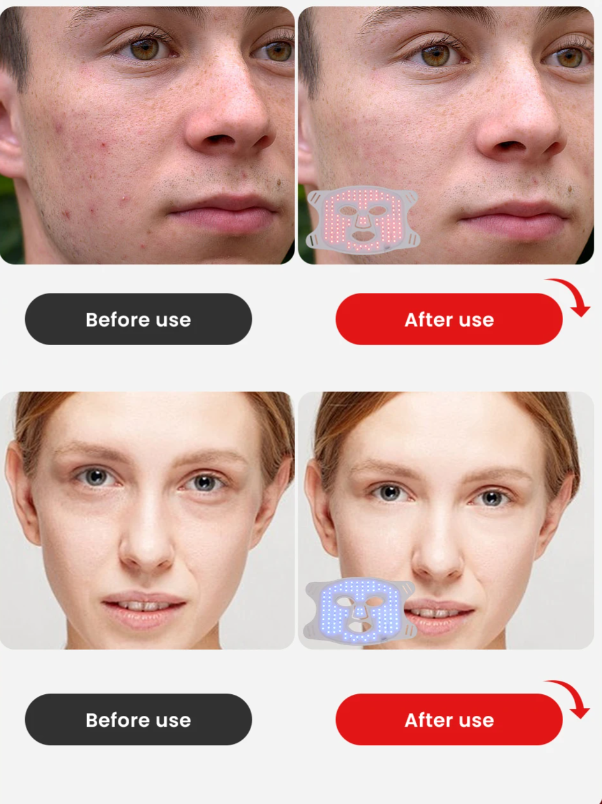 Before and after comparison of a facial treatment on two different individuals.