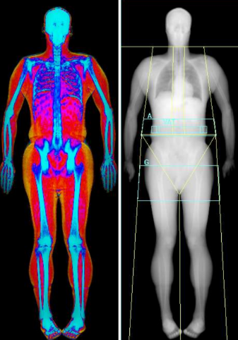Hologic Horizon DEXA WI ~Call for Pricing